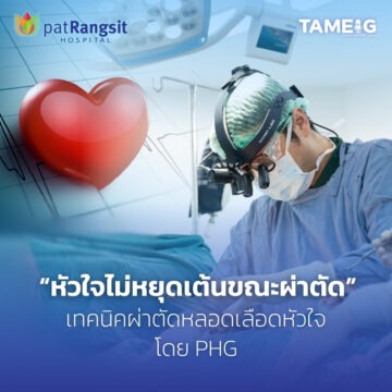 “หัวใจไม่หยุดเต้นขณะผ่าตัด” เทคนิคผ่าตัดหลอดเลือดหัวใจใหม่ ลดภาวะแทรกซ้อนผู้ป่วยโรคหัวใจ